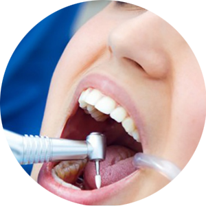 Những bệnh lý về răng miệng